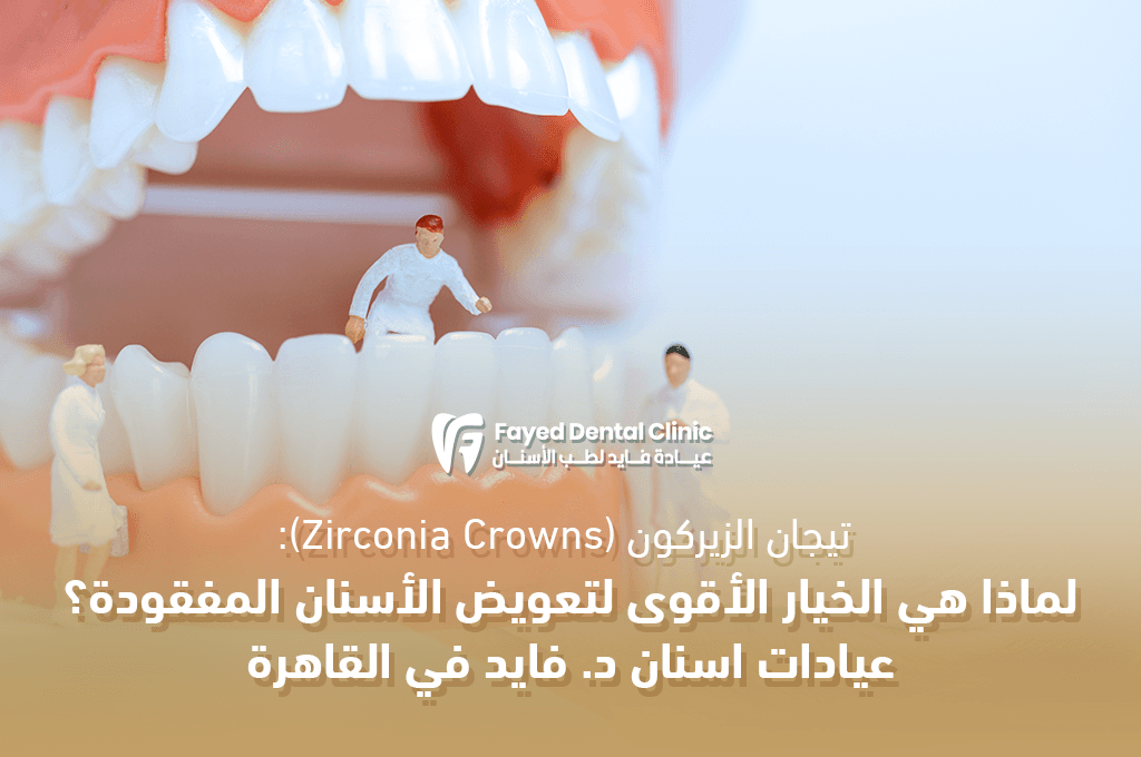 تيجان الزيركون في مصر: أقوى خيار لتعويض الأسنان – عيادة د. فايد بالقاهرة