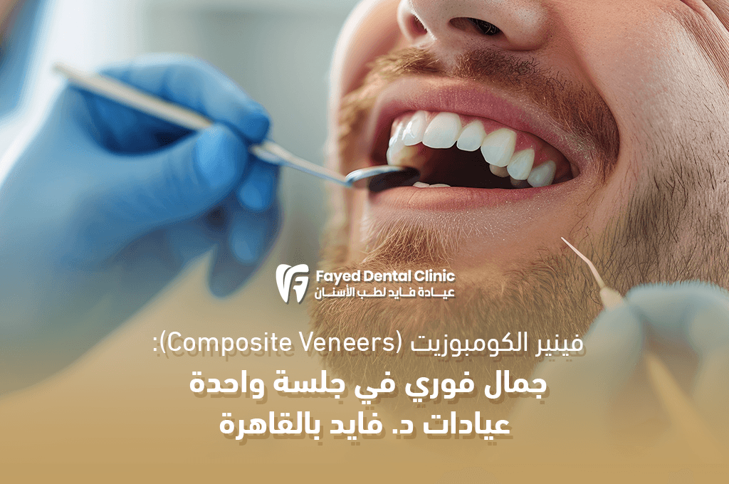 فينير الكومبوزيت (Composite Veneers): جمال فوري بدون برد للأسنان – عيادة د. فايد بالقاهرة