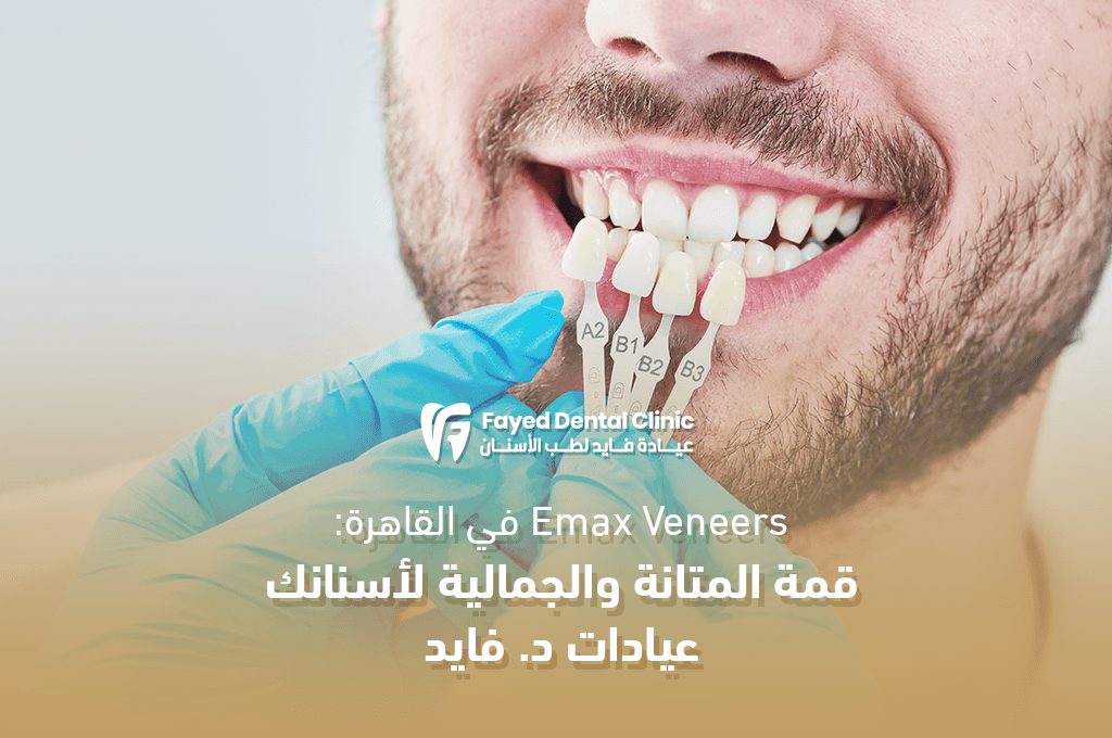 Emax Veneers في القاهرة: قمة المتانة والجاذبية لأسنانك – عيادة د. فايد