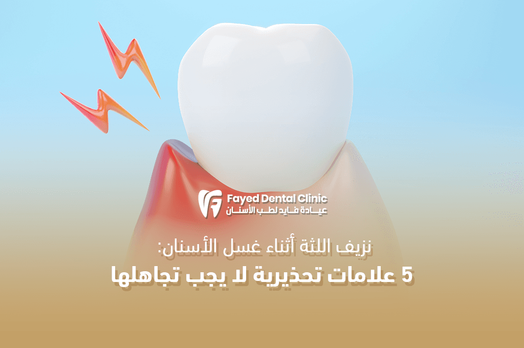 حلول نزيف اللثة عند غسل الأسنان من عيادة د. فايد في القاهرة