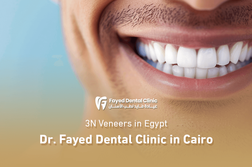 3N Veneers in Egypt – Dr. Fayed Dental Clinic in Cairo